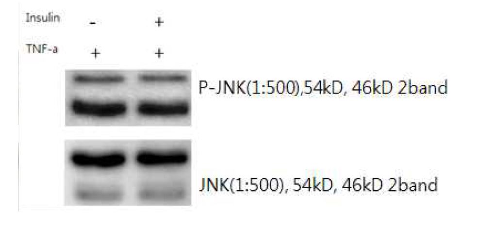 JNK Phosphorylation 실험 결과