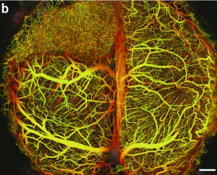 Vasculature of mouse brain tumor