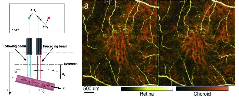 Dual beam scan Doppler flow detection scheme(left) and Retinal and choroidal vasculature of human eye(right)