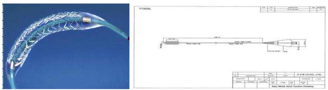 심혈관용 약물방출 스텐트 시스템