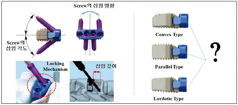 경추용 자립형 cage 제품의 설계 프로세스