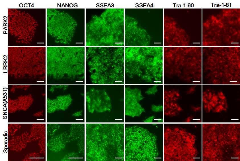 환자 iPSC의 만능성줄기세포 마커 발현 확인