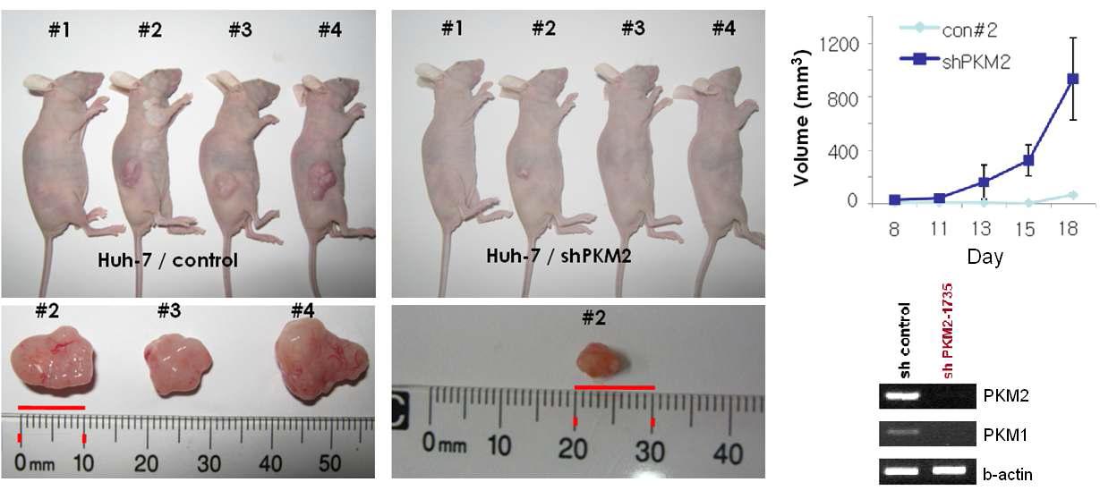 Mouse xenograft assay를 이용한 치료표적으로써의 PKM2의 in vivo 검증