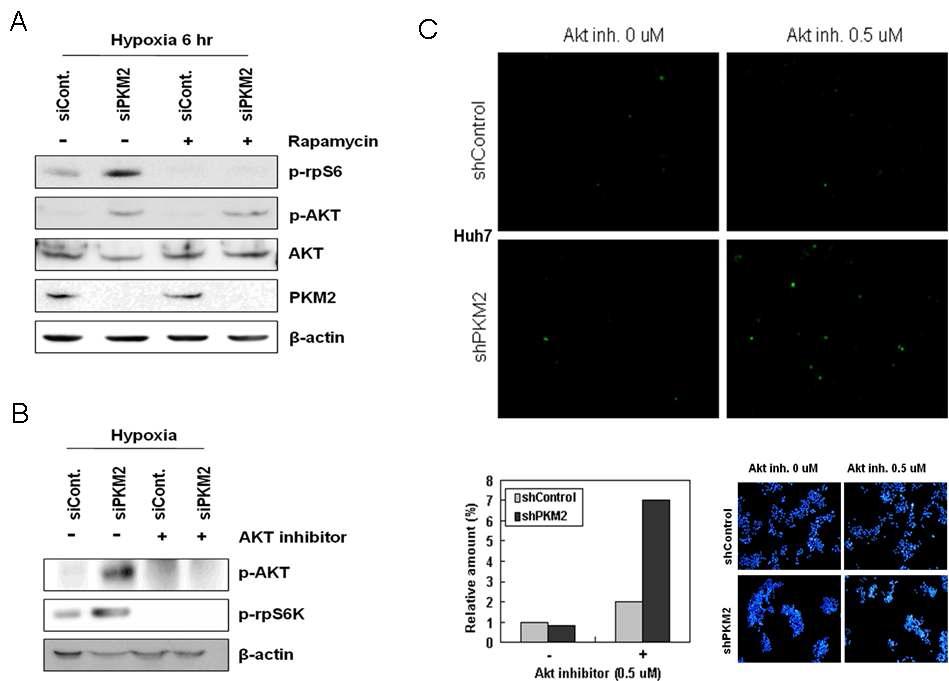 Hypoxia에서 PKM2 및 p-AKT 증가를 표적으로 한 combination therapy의 synergistic effects