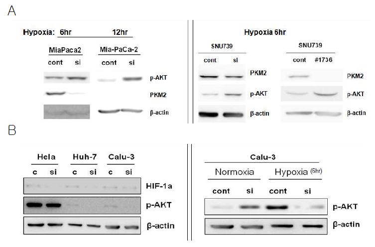 Hypoxia에 의한 AKT activation에 있어서 PKM2 발현억제 영향조사. PKM2 발현억제에 의한 세포주별 AKT activation 현상의 차이. (A) activation, (B) inactivation.