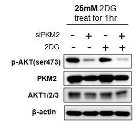 PKM2 발현억제 시 2-DG 의 유무 에 따른 AKT의 활성 확인.