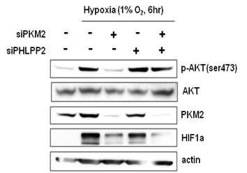 PKM2와 PHLPP2 발현 억제에 의한 AKT 활성 변화 측정.