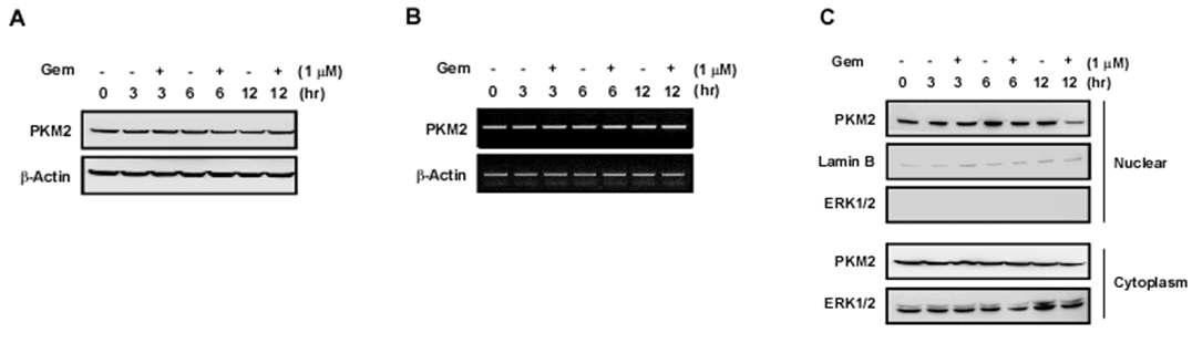 Gemcitabine 내성세포주에서 gemcitabine에 의한 PKM2 발현 및 localization 분석. Gemcitabine에 의한 (A) PKM2 단백질 양, (B) PKM2 전사레벨, (C) PKM2 localization 변화