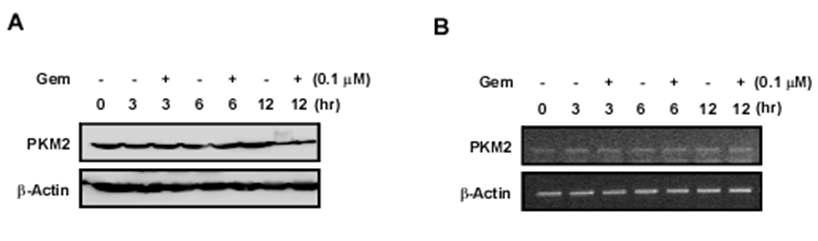 Gemcitabine 감수성 세포주에서 gemcitabine에 의한 PKM2 발현 및 localization 분석. Gemcitabine에 의한 (A) PKM2 단백질 양, (B) PKM2 전사레벨