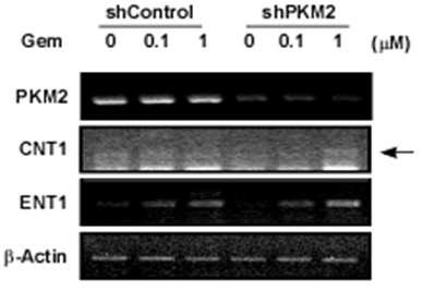 PKM2 발현감소 및 gemcitabine에 의한 transporter 발현 변화. Gemcitabine 내성 세포주에 PKM2 발현감소와 gemcitabine에 의한 transporter 전사 변화