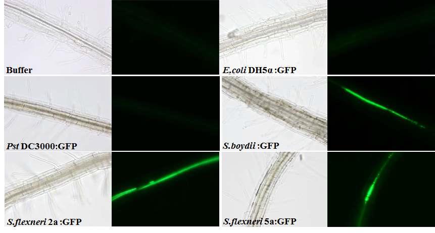 도관부에서의 Shigella 이동과 세포안 증식