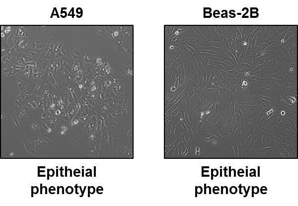 배양중인 비소세포 폐암세포 A549와 불멸화 기관지 세포 Beas-2B 세포 형태.