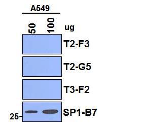 Western blot에 의한 비소세포 폐암세포 A549에 대한 단일클론항체의 결합능 분석.
