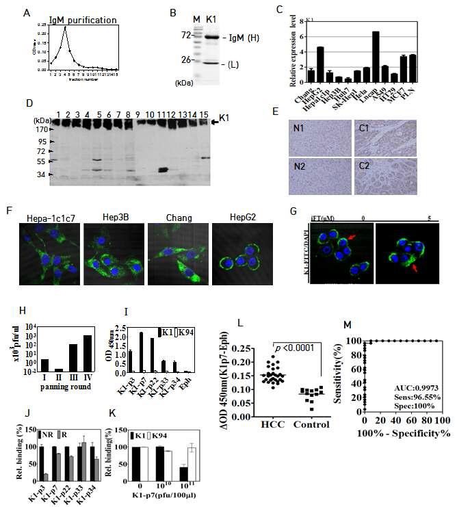 항-지방산합성효소(Fatty Acid Synthase:FASN) 자가면역항체를 포함하는 간암 진단 마커 및 이의 항원을 포함하는 간암진단용 조성물