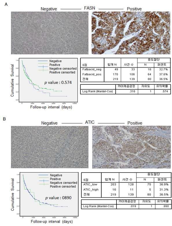 간암 Tissue microarray 염색 및 분석결과