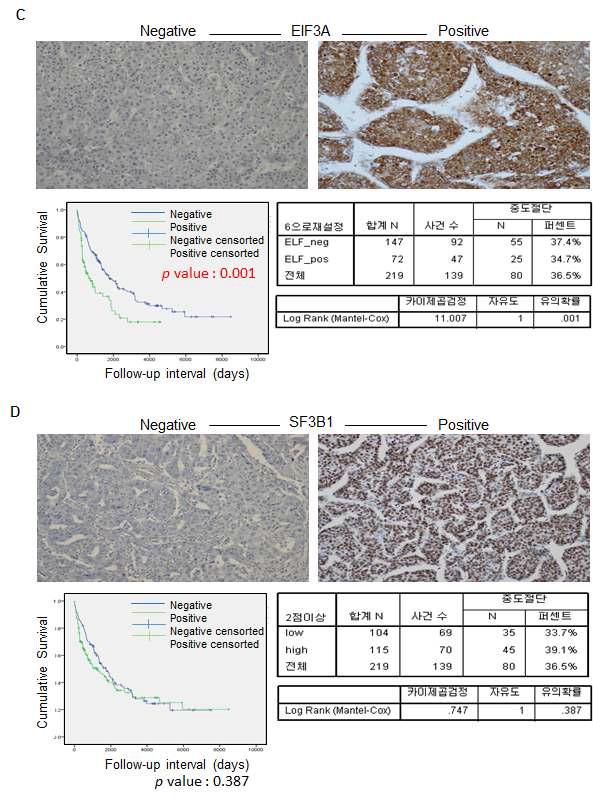 간암 Tissue microarray 염색 및 분석결과