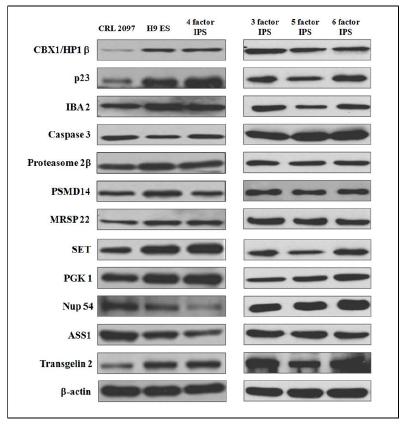 Western blot 실험을 통한 발굴 단백질의 검증