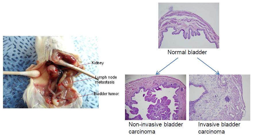 BBN에 의한 방광암 형성 및 림프절 전이 및 신장 이상 유도 예
