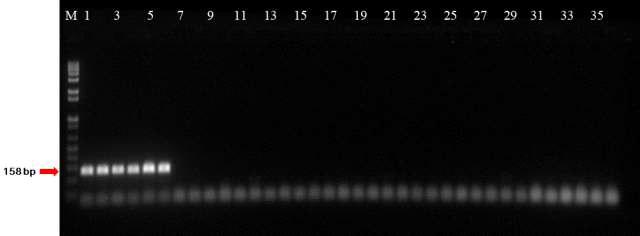 PCR amplification of a YD repeat protein gene from Acidovorax avenae subsp. citrulli using subspecies-specific AC158F/R primer set. Lane M, Size marker (1Kb plus DNA ladder; Gibco BRL TM); lanes 1-35 listed in Table 1. Lane 36, Distilled Water.