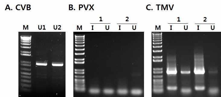 Detection of CVB, PVX and TMV by RT-PCR with specific primers in those virus infected chrysanthemum plants