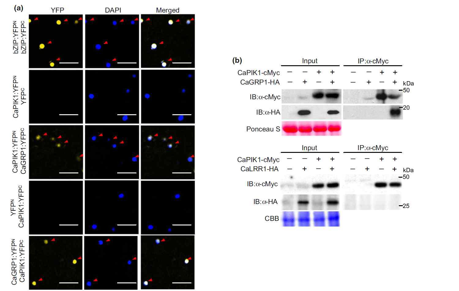 Capsicum annuum RECEPTOR-LIKE CYTOPLASMIC PROTEIN KINASE1 (CaPIK1) interacts with GLYCINE-RICH RNA-BINDING PROTEIN1 (CaGRP1) in planta.