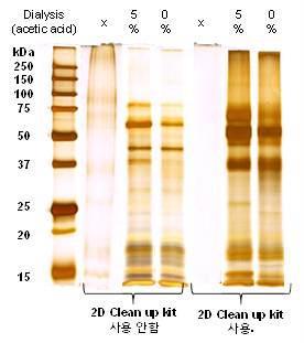 SDS-PAGE analysis of hens eggshell protein