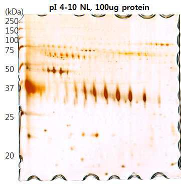 Representative two-dimensional electrophoresis (2DE) image of hen