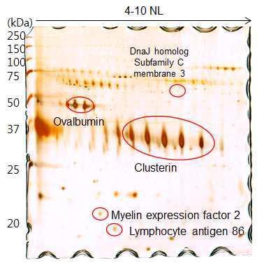 Identification of hens eggshell proteins