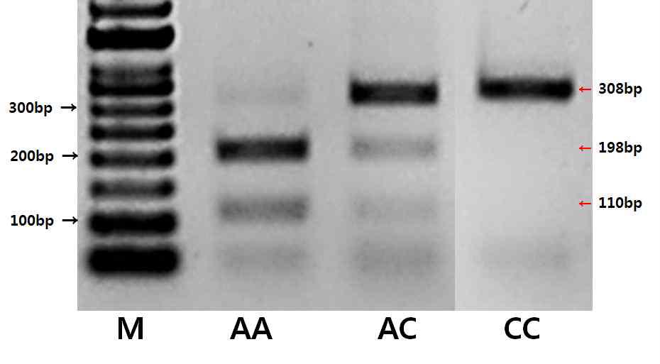 SNP10의 PCR-RFLP에 따른 밴드패턴