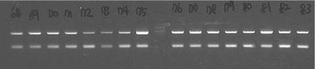 SLA-GSBT 분석법을 사용하여 조기사망군과 정상돈군간의 SLA-DQB1 PCR product 전기영동 (electrophoresis) 결과의 예.