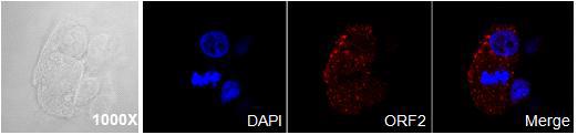 PCV2의 숙주세포(PK15 세포) 내 감염 확인. 공초점현미경(confocal microscopy)으로 PCV2가 감염된 PK15 세포주에서 PCV2 ORF 2에 대한 항체로 PCV2 ORF 2가 PCV2가 감염된 PK15 세포 안에 있음을 확인하였음. DAPI, DNA를 염색; red fluorescence, PCV2 ORF 2에 대한 항체; merge, DAPI 염색과 PCV2 ORF 2에 대한 항체의 merge. PCV2 ORF 2는 PCV2의 capsid protein이기 때문에 핵 밖에서 uncoating 됨.