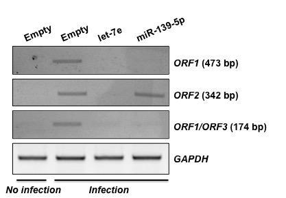 RT-PCR을 통한 let-7e 및 miR-139-5p의 PCV2 감염 저항성 확인 Empty vector, let-7e, 및 miR-139-5p를 과발현 시킨 PK15 세포에 PCV2 감염을 유도한 후 RT-PCR을 통해 각 PCV2 ORF들의 mRNA 양을 확인하여 PCV2 감염 저항성 여부를 판단함. let-7e 과발현 시 positive control (lane 2)에 비해 현저하게 PCV2 ORF들의 발현이 감소함을 확인하였으며, miR-139-5p 과발현 시 PCV2 ORF2를 제외한 ORF1, ORF3의 발현양이 감소함을 확인함.