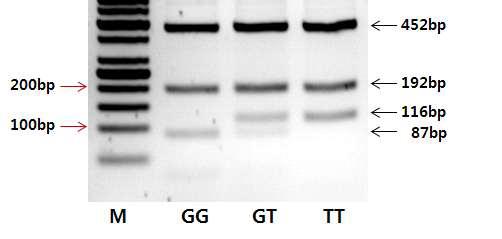 RGS16 유전자 SNP1의 PCR-RFLP 절편사진 M, 50bp ladder size marker (Intronbio., Korea)