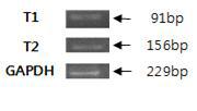 RT-PCR을 통한 말 DYNC1LI2 유전자 alternative transcript 검증