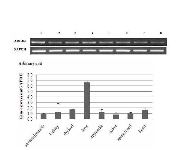 말의 조직별 ADR-β2 유전자 발현 분석