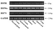 말의 조직별 HSP 유전자들의 RT-PCR
