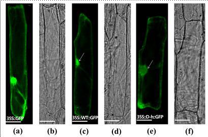 D-h gene subcellular localization (좌; control, 중; wild type, 우; mutant).