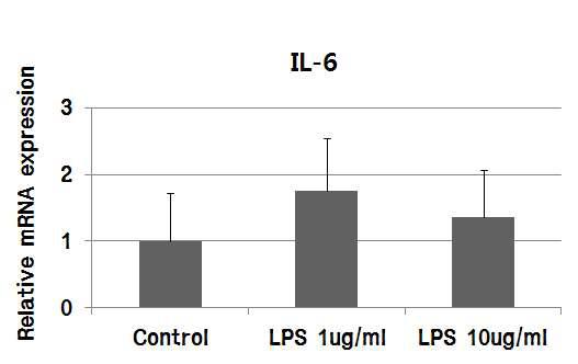 LPS 처리수준에 따른 IPEC-J2 내 IL-6의 변화