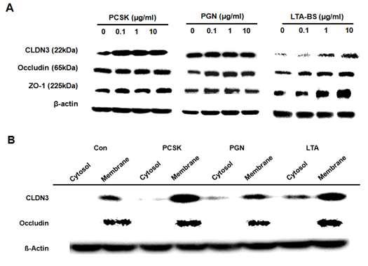 TLR2 리간드의 처리를 통해 돼지 장상피세포의 타잇정션 단백질 변화.