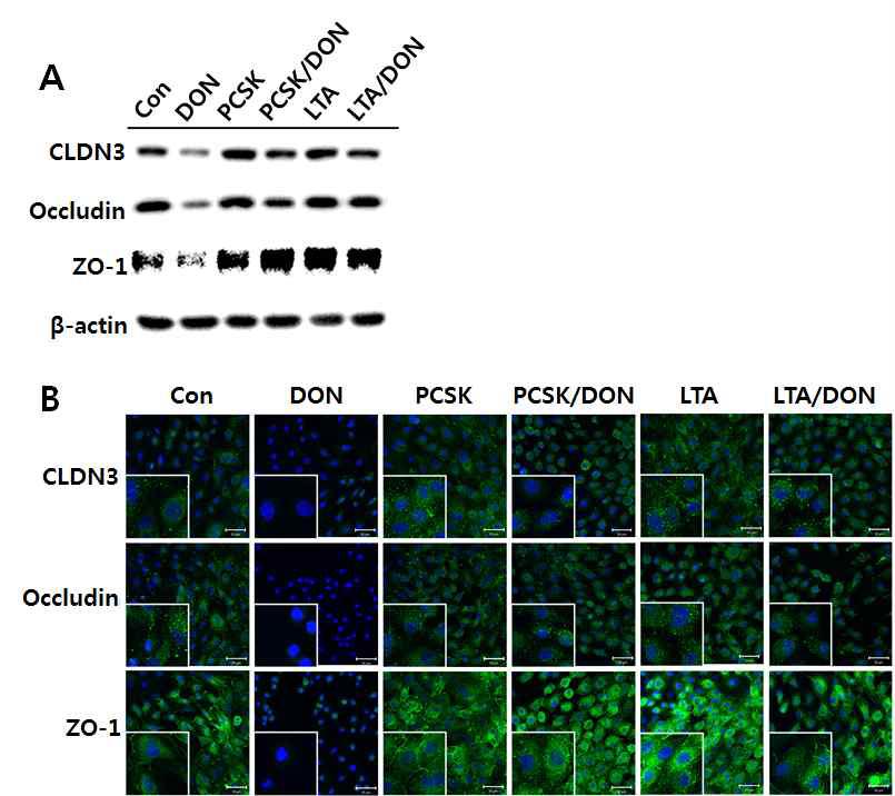 TLR2 리간드에 의한 타잇정션 단백질 발현 변화