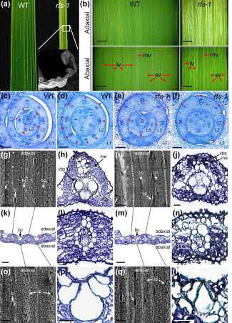 Characterization of rfs-1 leaf.