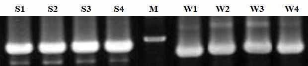 Colony PCR to confirm the recombinant plasmids.