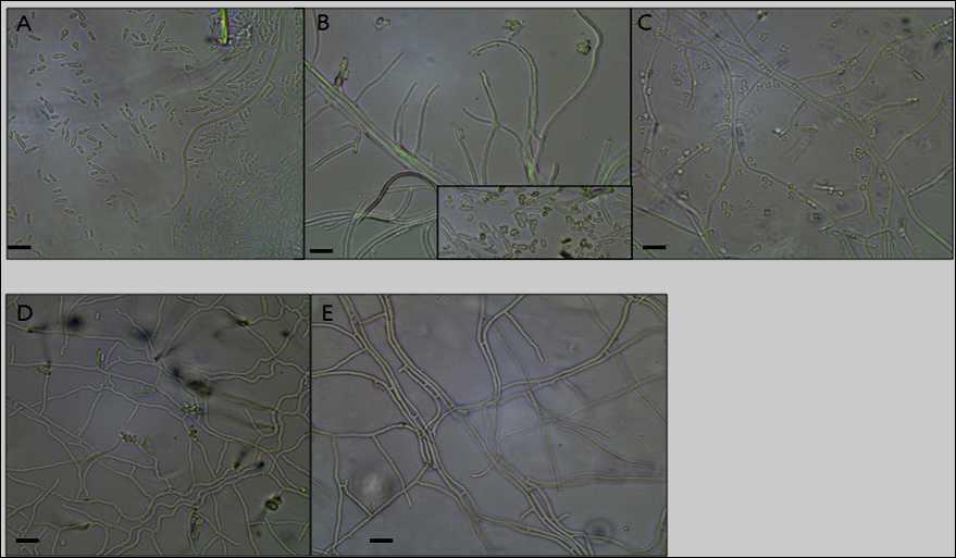 각 조건별 배양된 붉은자루동충하초 균사체 현미경 사진.