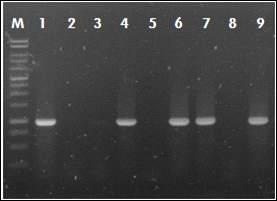 붉은자루동충하초 NRPS 381 gene knock out mutant를 barsta gene PCR 확인