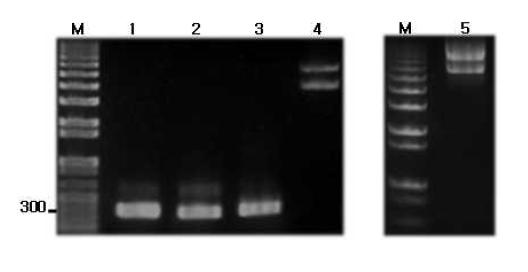 Electrophoretic pattern of PCR products of N-term, Middle and C-term.