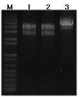 Electrophoretic pattern of pDONR201::Chi N-term, pDONR201::Chi Middle andpDONR207::Chi C-term clones. M: 1kb+DNA ladder, 1: pDONR201::Chi N-term, 2: