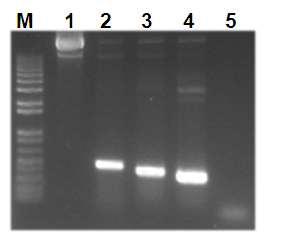 Electrophoretic pattern and PCR for confirmation of pK7GWIWG2 (II)::Chi Middleclone. M: 1kb+ DNA ladder, 1: pK7GWIWG2 (II)::Chi Middle, 2: Chi Middle gene. 3: Chi
