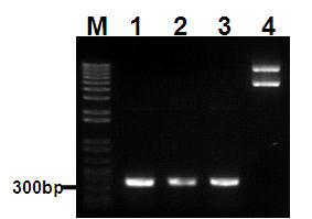 Electrophoretic pattern of PCR products of N-term, Middle and C-term of Tomatospotted wilt virus.