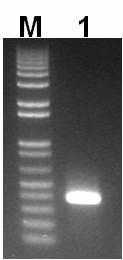 Electrophoretic patterns of RT-PCR products of hp-CMV1 for CMV-Ca-P1.