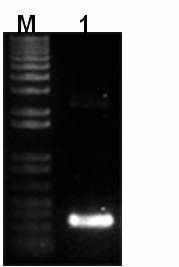 Electrophoretic patterns of RT-PCR products of hp-CMV2 for CMV-Ca-P1.